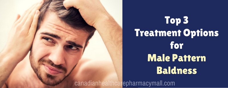 Top 3 Treatment Options for Male Pattern Baldness